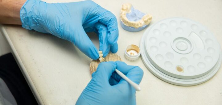 implantes dentales precio