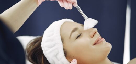 chemical peeling treatment